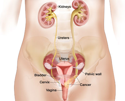 Ureter Oncology