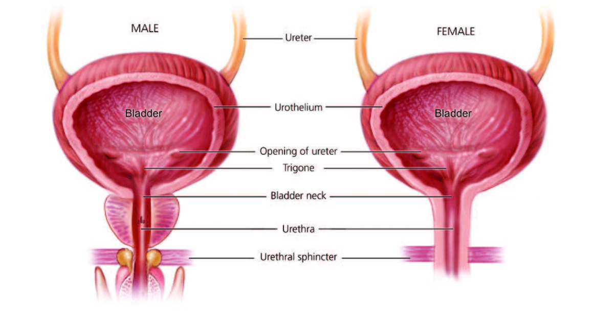 Bladder Cancer